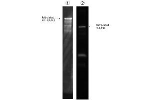 anti-TLS/FUS (2meArg216 (asymetric)), (2meArg218 (asymetric)) antibody