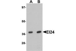 Western blot analysis of EI24 in rat liver tissue lysate with EI24 antibody at (A) 1 and (B) 2 ug/mL. (EI24 Antikörper  (C-Term))