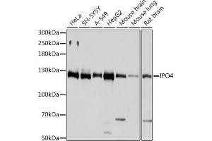 Western blot analysis of extracts of various cell lines, using IPO4 antibody  at 1:1000 dilution. (Importin 4 Antikörper  (AA 728-1081))