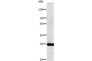 Western Blot analysis of Mouse lung tissue using RALB Polyclonal Antibody at dilution of 1:250 (RALB Antikörper)