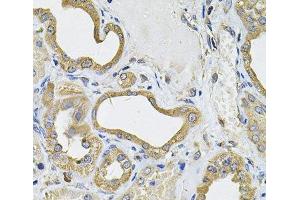 Immunohistochemistry of paraffin-embedded Human kidney using ICOSL Polyclonal Antibody at dilution of 1:100 (40x lens). (ICOSLG Antikörper)