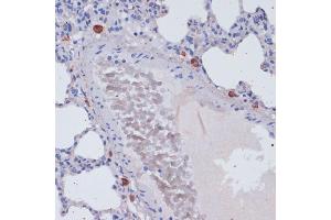 Immunohistochemistry of paraffin-embedded rat lung using Perforin antibody (ABIN3020641, ABIN3020642, ABIN3020643 and ABIN6213612) at dilution of 1:100 (40x lens).