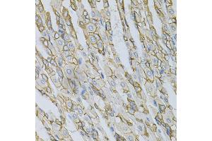 Immunohistochemistry of paraffin-embedded mouse stomach using AP2B1 Antibody (ABIN5971039) at dilution of 1/100 (40x lens). (AP2B1 Antikörper)