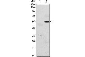Western Blot showing EIF2AK3 antibody used against HEK293 (1) and EIF2AK3 (AA: 929-1116)-hIgGFc transfected HEK293 (2) cell lysate. (PERK Antikörper)