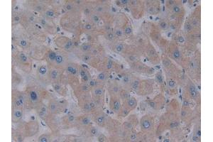 IHC-P analysis of Human Liver Tissue, with DAB staining. (Asialoglycoprotein Receptor 1 Antikörper  (AA 77-289))