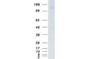 Validation with Western Blot (PASK Protein (Myc-DYKDDDDK Tag))