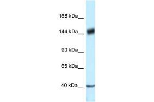 WB Suggested Anti-PELP1 Antibody Titration: 1. (PELP1 Antikörper  (C-Term))