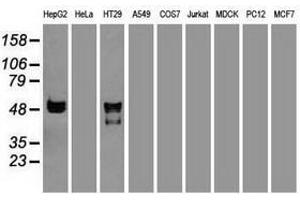 Image no. 2 for anti-serpin Peptidase Inhibitor, Clade A (Alpha-1 Antiproteinase, Antitrypsin), Member 1 (SERPINA1) (AA 26-418) antibody (ABIN1491294) (SERPINA1 Antikörper  (AA 26-418))