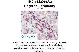 Image no. 1 for anti-Solute Carrier Family 44, Member 2 (SLC44A2) (Internal Region) antibody (ABIN1739381)