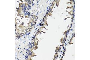 Immunohistochemistry of paraffin-embedded human prostate using OTC antibody. (OTC Antikörper  (AA 215-354))