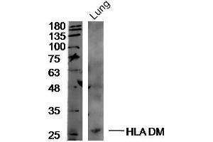 Mouse lung lysates probed with Rabbit Anti-HLA DM Polyclonal Antibody, Unconjugated  at 1:300 overnight at 4˚C. (HLA-DM Antikörper  (AA 101-200))