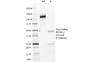 SDS-PAGE Analysis Purified NKX2. (Nkx2-2 Antikörper)