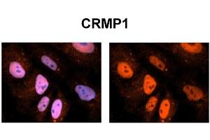 Immunohistochemistry (IHC) image for anti-Collapsin Response Mediator Protein 1 (CRMP1) (N-Term) antibody (ABIN2777073)