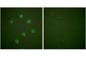 Immunofluorescence (IF) image for anti-Antigen Identified By Monoclonal Antibody Ki-67 (MKI67) (AA 3207-3256) antibody (ABIN2889217) (Ki-67 Antikörper  (AA 3207-3256))