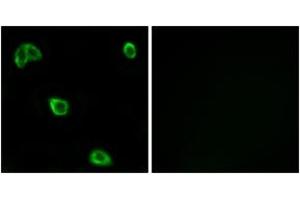 Immunofluorescence analysis of LOVO cells, using OR10K1/10K2 Antibody. (OR10K1/K2 Antikörper  (AA 56-105))