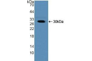 Western blot analysis of recombinant Human NUP50. (NUP50 Antikörper  (AA 37-269))