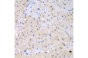 Immunohistochemistry of paraffin-embedded mouse heart using ARHGEF9 antibody (ABIN5975759) at dilution of 1/100 (40x lens). (Arhgef9 Antikörper)