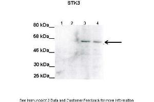 Lanes:   Lane1: 100ug uninduced RPE-1 lysate Lane2: 100ug uninduced RPE-1 lysate Lane3: 100ug STK3 induced RPE-1 lysate Lane4: 100ug STK3 induced RPE-1 lysate  Primary Antibody Dilution:   1:2000  Secondary Antibody:   Anti-rabbit HRP  Secondary Antibody Dilution:   1:5000  Gene Name:   STK3  Submitted by:   Anonymous