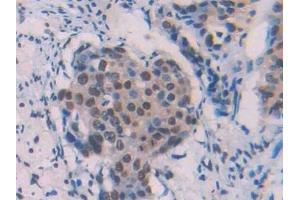 Immunohistochemistry (IHC) image for anti-Amyloid beta 1-42 (Abeta 1-42) antibody (ABIN7427870)