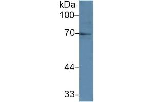 Detection of IL1R1 in Human Raji cell lysate using Polyclonal Antibody to Interleukin 1 Receptor Type I (IL1R1) (IL1R1 Antikörper  (AA 386-553))