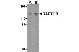 Western Blotting (WB) image for anti-RAPTOR (RAPTOR) (C-Term) antibody (ABIN1030614) (RAPTOR Antikörper  (C-Term))