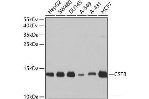 Western blot analysis of extracts of various cell lines using CSTB Polyclonal Antibody at dilution of 1:1000. (CSTB Antikörper)