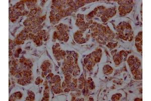 anti-Solute Carrier Family 16, Member 1 (Monocarboxylic Acid Transporter 1) (SLC16A1) antibody