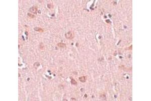 Immunohistochemical staining of human liver tissue with 5 ug/mL PLEKHM2 polyclonal antibody . (PLEKHM2 Antikörper  (C-Term))