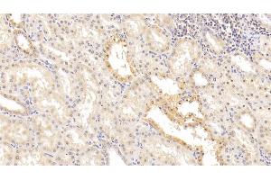 Detection of ITGb1 in Human Kidney Tissue using Monoclonal Antibody to Integrin Beta 1 (ITGb1) (ITGB1 Antikörper  (AA 140-383))