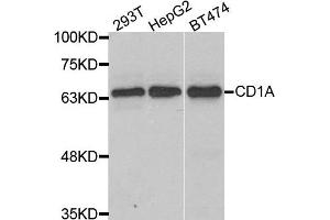 Western blot analysis of extracts of various cell lines, using CD1A antibody. (CD1a Antikörper)