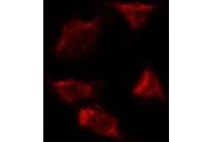 ABIN6277505 staining Hela by IF/ICC. (AIMP1 Antikörper  (Internal Region))