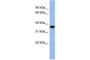 WB Suggested Anti-FANCL Antibody Titration: 0. (FANCL Antikörper  (Middle Region))
