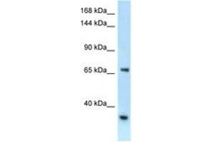 RBM15B Antikörper  (AA 606-655)