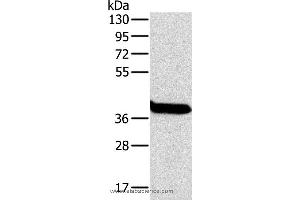 Western blot analysis of Mouse liver tissue, using OTC Polyclonal Antibody at dilution of 1:800 (OTC Antikörper)
