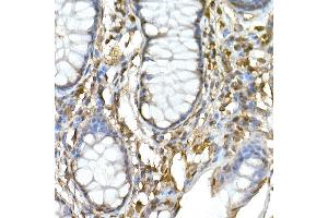 Immunohistochemistry (IHC) image for anti-Tumor Necrosis Factor, alpha-Induced Protein 3 (TNFAIP3) (AA 1-190) antibody (ABIN3022985)