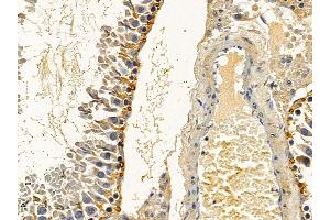 ABIN6258281 and ABIN6275236 at 1/100 staining rat testis tissue by IHC-P.