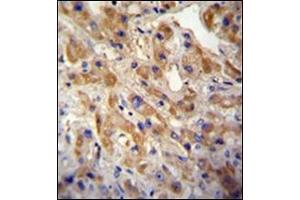Immunohistochemistry (IHC) image for anti-Met Proto-Oncogene (MET) (Catalytic Domain) antibody (ABIN356340) (c-MET Antikörper  (Catalytic Domain))