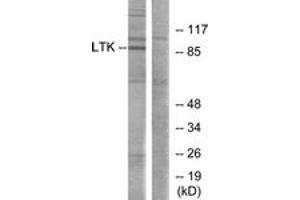 Western blot analysis of extracts from Jurkat cells, using LTK Antibody.
