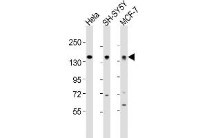 All lanes : Anti-ML2 Antibody (Center) at 1:2000 dilution Lane 1: Hela whole cell lysates Lane 2: SH-SY5Y whole cell lysates Lane 3: MCF-7 whole cell lysates Lysates/proteins at 20 μg per lane. (MAML2 Antikörper  (AA 780-814))