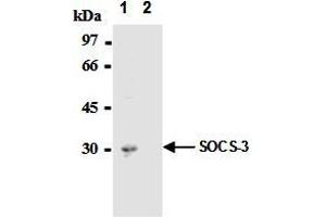 Immunoprecipitation of SOCS-3 from mouse hepatocytes with AM26562AF-N  or mouse IgG1  After immunoprecipitated with the antibody, immunocomplex was resolved on SDS-PAGE and immunoblotted with biotinylated anti-SOCS-3 monoclonal antibody. (SOCS3 Antikörper  (AA 2-44))