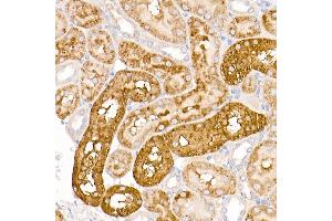 Immunohistochemistry of paraffin-embedded rat kidney using WRB Rabbit pAb (ABIN6129154, ABIN6150261, ABIN6150262 and ABIN6222768) at dilution of 1:250 (40x lens). (WRB Antikörper  (AA 30-100))