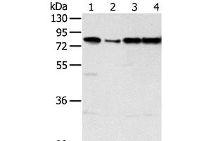 Western Blot analysis of Jurkat, hepg2, Raji and A431 cell using TAF15 Polyclonal Antibody at dilution of 1:450 (TAF15 Antikörper)