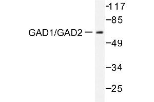 Image no. 2 for anti-Glutamate Decarboxylase 1 (Brain, 67kDa) (GAD1) antibody (ABIN271888) (GAD Antikörper)
