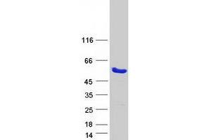 Western Blotting (WB) image for DNA-Damage Inducible 1 Homolog 2 (DDI2) protein (Myc-DYKDDDDK Tag) (ABIN2719265)