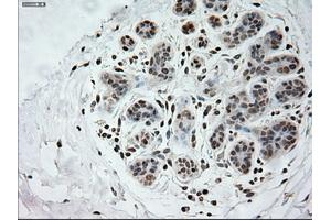 Immunohistochemical staining of paraffin-embedded breast tissue using anti-PROM2 mouse monoclonal antibody.