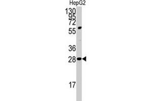 Western blot analysis of PDX1 polyclonal antibody  in HepG2 cell line lysates (35 ug/lane).