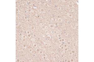 Immunohistochemistry (IHC) image for anti-VEGF Receptor 2 (VEGFR2) (AA 20-200) antibody (ABIN6142816)