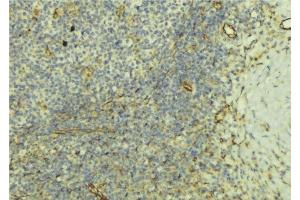 ABIN6277380 at 1/100 staining Human lymph tissue by IHC-P.