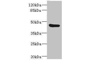 Western blot All lanes: BAAT antibody IgG at 3. (BAAT Antikörper  (AA 309-418))