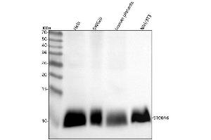 Western blot analysis of S100A6 using anti-S100A6 antibody (ABIN7606223).